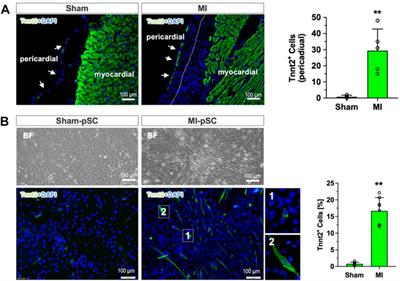 Cardiac commitment driven by MyoD expression in pericardial stem cells